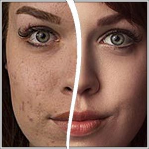 Glamour Retouching